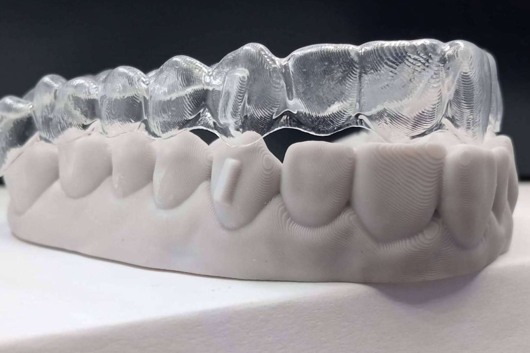 Las ventajas de elegir Smile Aligner como ortodoncia invisible